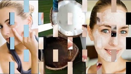 Căng da mặt nội soi để có làn da căng mịn như ý