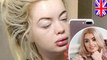Plastic surgery gone wrong: UK youngest lotto winner’s face bloated after butt surgery