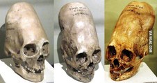 alien elongated skulls or the nephilim's hybrids around the world