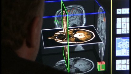 BBC: Introducing the World's Largest Sleep Study