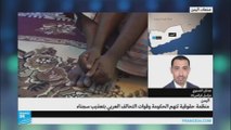 عدنان الصنوي-اليمن-حالات التعذيب