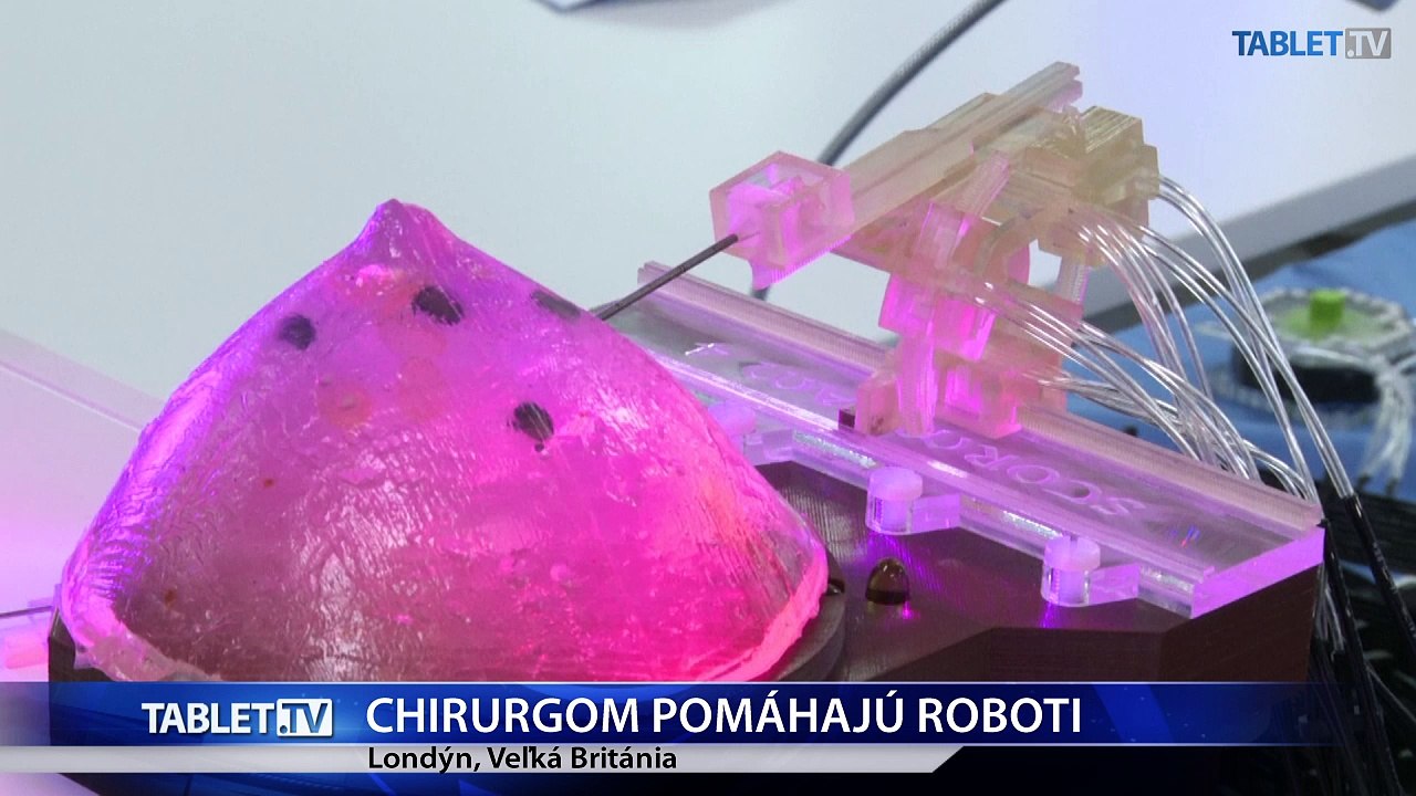 Roboty operujú oči, pečeň a odstraňujú nádory