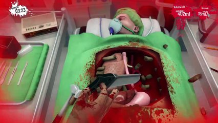 Surgeon Simulator (3)