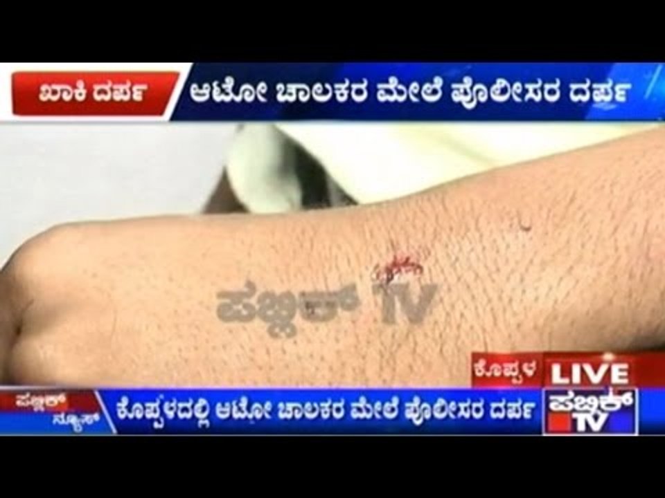 Koppal: Police Constables Attack Auto Drivers Without Reason