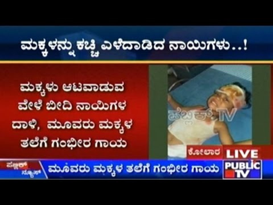 Kolar: 3 Children Severely Injured After Being Attacked By Dogs