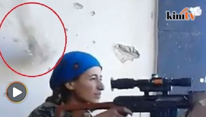 Peluru hampir tembus kepala, wanita Kurdish hanya mampu senyum