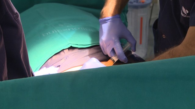 Nueva técnica sin cirugía para tratar la disfunción eréctil