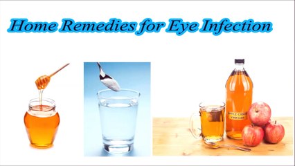 Home Remedies for Eye Infection