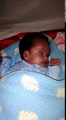 "JOLIE" TIENE UN MES DE NACIDA, TIENE HIDROCEFALIA