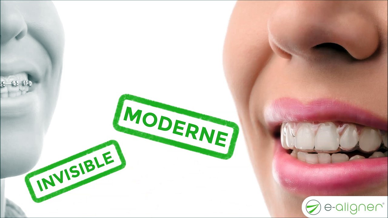 E-ALIGNER : La solution innovante d'alignement dentaire par gouttières transparentes