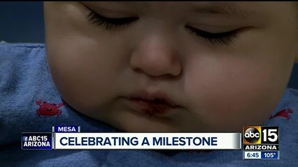 Baby boy born with heart disease celebrated by hospital staff