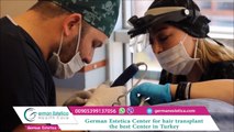 hair transplant turkey and hair transplant surgery  German Estetica