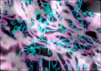 Sungguh Ku Rindu Padamu DJ Remix Asbak Funkot