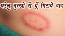 Ringworm infection: Home Remedies | दाद के लिए करें यें घरेलू उपाय | Boldsky