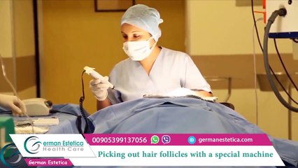 trapianto capelli fue turchia prima e dopo 00905399137056  german estetica