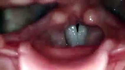 Como suas cordas vocais funcionam quando você canta