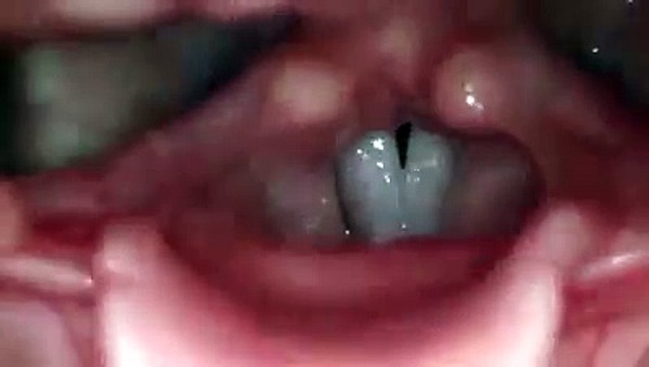 Como suas cordas vocais funcionam quando você canta