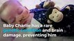 What you should know about the terminally ill baby Charlie Gard