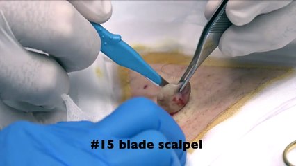 What Is It? Cyst, Wart, Ingrown Hair, Infected Boil?