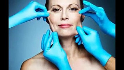 Công nghệ căng da mặt giúp trẻ hóa da hiệu quả