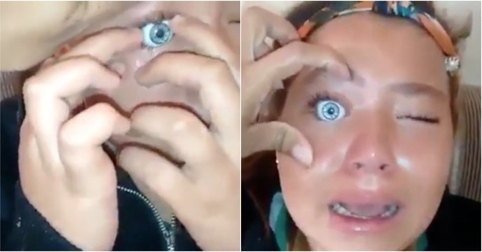 Criança que queria olhos azuis coloca olho de boneca no próprio olho