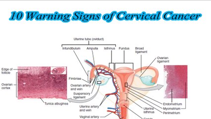 10 Warning Signs of Cervical Cancer