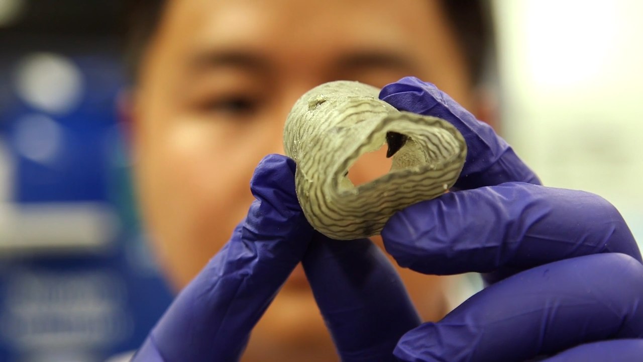 This 3D-Printed Heart Valve Could Save Lives