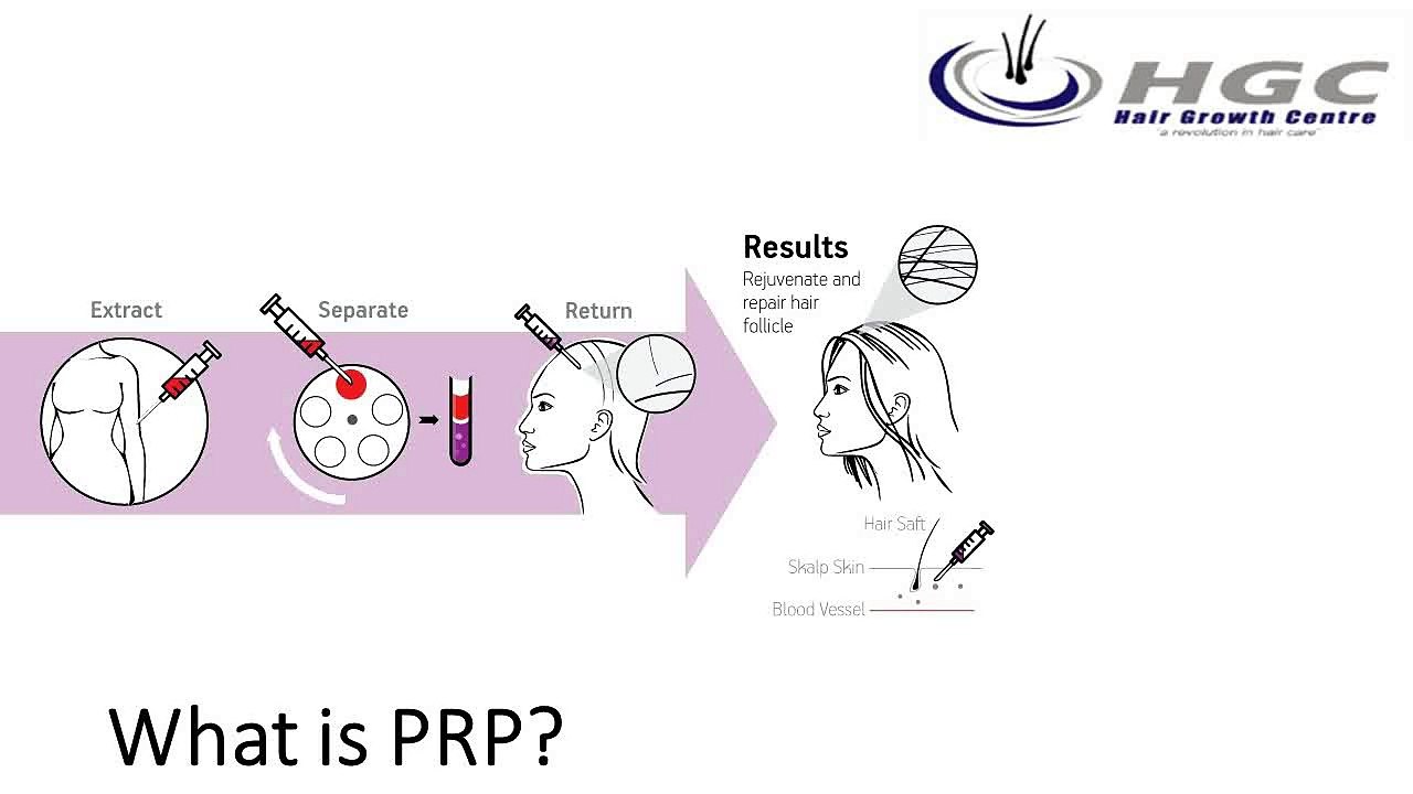 What is PRP