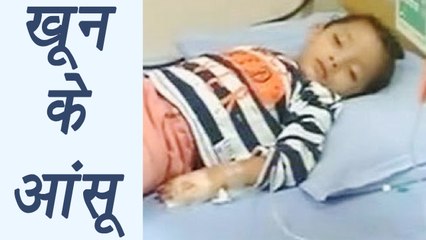 Hyderabad 3 year old girl crying tears of blood; Here's why  । वनइंडिया हिंदी