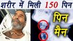 Rajasthan: 100 pins found in man's body; 55 more still there | SHOCKING | वनइंडिया हिंदी