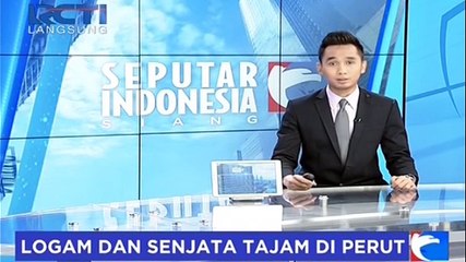 Perut Seorang Pria Berisi Logam dan Benda Tajam Di Perutnya