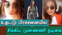 Actress Priyanka gets trolled for her lip surgery-Filmibeat Tamil