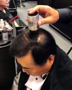 Ce chauve retrouve des cheveux en quelques secondes !