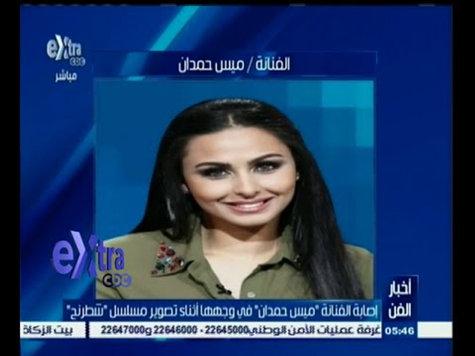 #غرفة_الأخبار | إصابة الفنانة "ميس حمدان" في وجهها أثناء تصوير مسلسل "شطرنج"