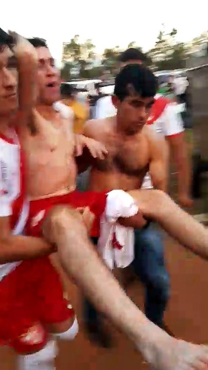 Herido durante pelea luego del súper clásico Curuguateño