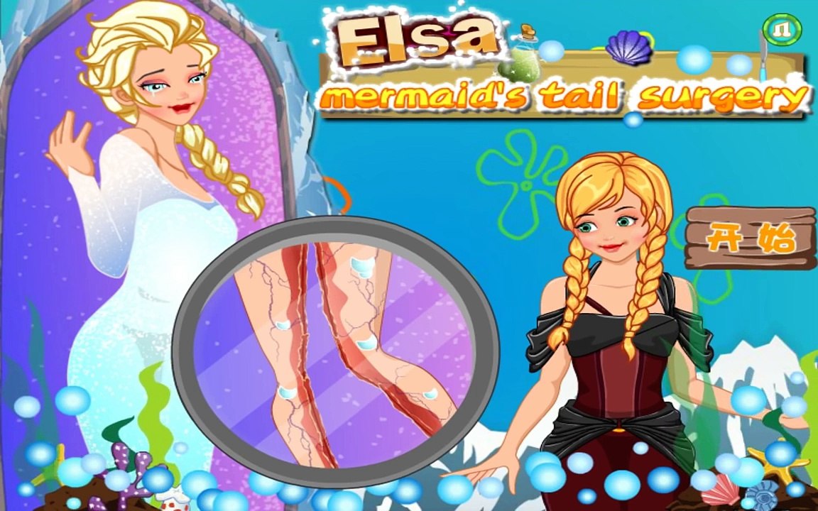 Disney Frozen Elsa Mermaid Tail Surgery game - Doctor games for kids