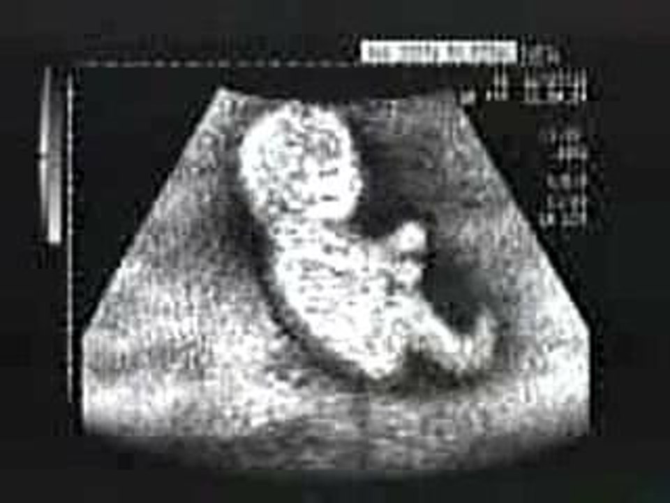 bébé pilote