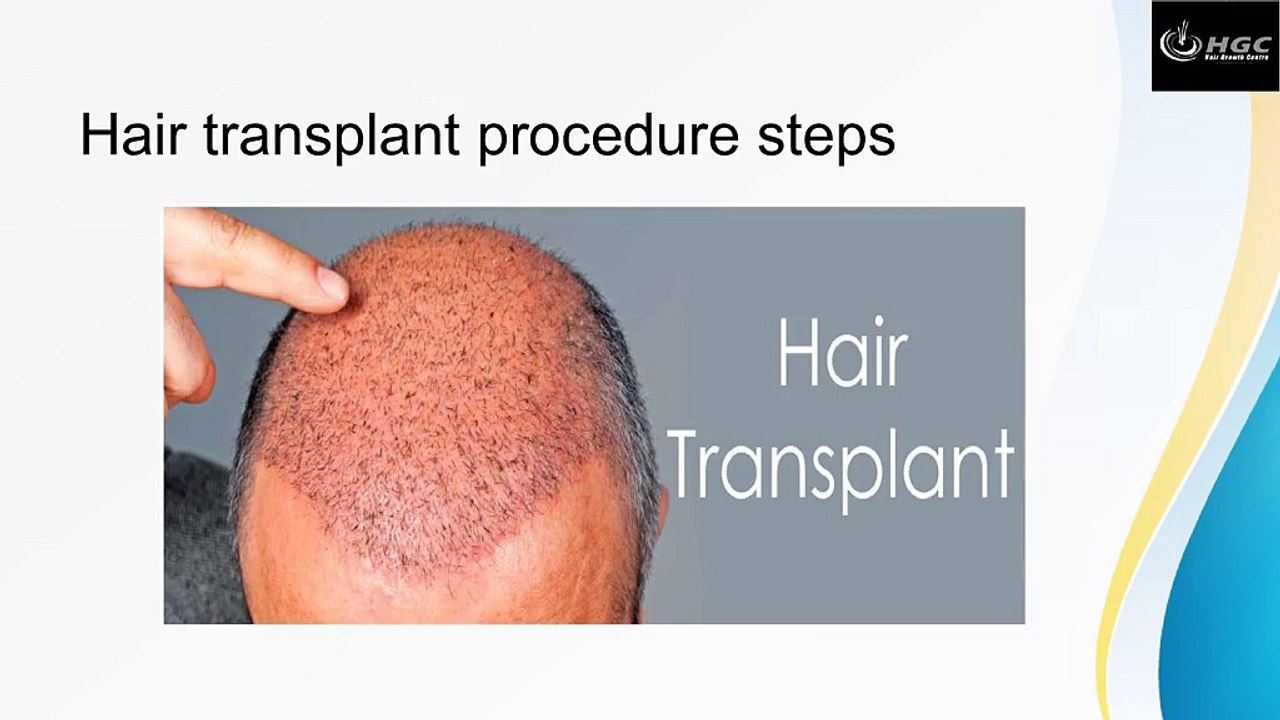 Hair transplant procedure steps
