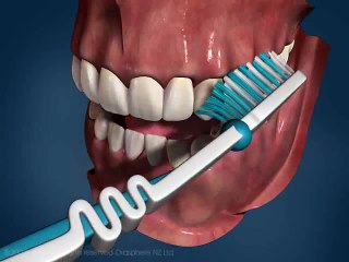 Tooth Brushing video PEV