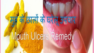 मुहं के छालों के घरेलू उपचार । Home remedies for Mouth Ulcers