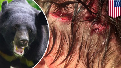 Teen wakes to find bear chewing on his scalp, then drags him away