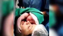 Ce nouveau-né ne veut pas lacher sa maman alors qu'il vient de naitre