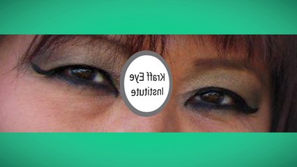 Lasik Chicago IL - Kraff Eye Institute (312) 444-1111