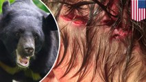 Beruang menyerang & menyeret remaja ke hutan saat ia tertidur - Tomonews