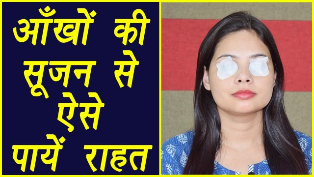 Eye Swelling | Home Remedy | घर में आँखों की सूजन से जल्दी पायें राहत | DIY | BoldSky