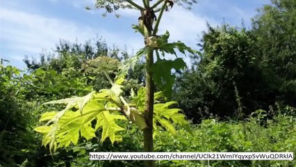 HOGWEED WARNING: Children left with horrific injuries as poisonous plant sweeps across UK