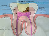 4 Root Canal Alternatives