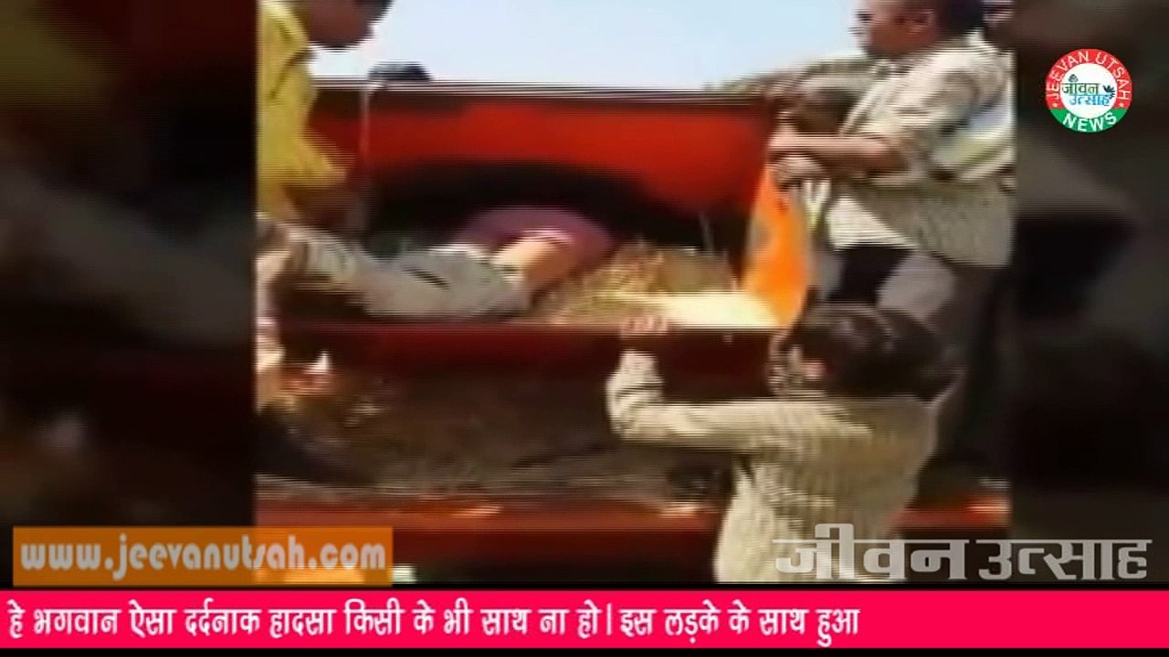 हे भगवान ऐसा दर्दनाक हादसा किसी के भी साथ ना हो। इस लड़के के साथ हुआ रूह काँपा देने वाला हादसा।