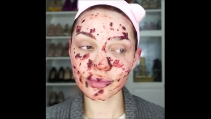 Best Skin Care Compilation Oily & Dry Skin, Blackhead