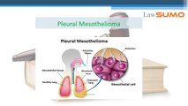 mesothelioma law firms - lawyers & Attorneys